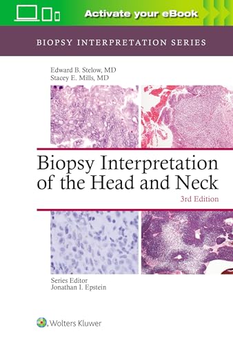 Biopsy Interpretation of the Head and Neck (Biopsy Interpretation Series) von Lippincott Williams & Wilkins