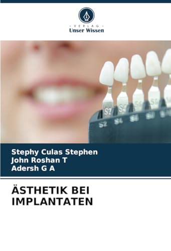 ÄSTHETIK BEI IMPLANTATEN: DE