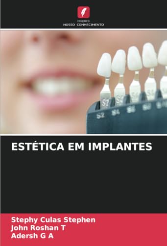 ESTÉTICA EM IMPLANTES: DE von Edições Nosso Conhecimento