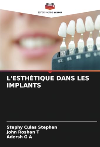 L'ESTHÉTIQUE DANS LES IMPLANTS: DE von Editions Notre Savoir