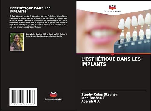 L'ESTHÉTIQUE DANS LES IMPLANTS: DE