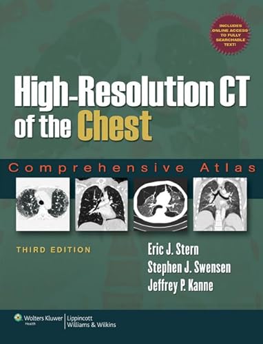 High-Resolution CT of the Chest: Comprehensive Atlas High-Resolution CT of the Chest: Comprehensive Atlas