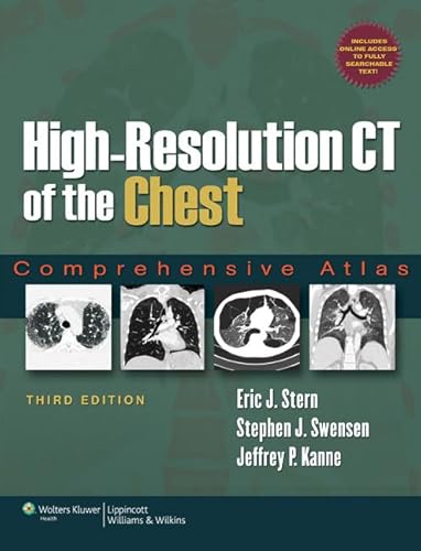 High-Resolution CT of the Chest: Comprehensive Atlas