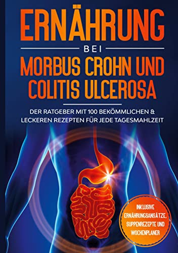 Ernährung bei Morbus Crohn und Colitis Ulcerosa: Der Ratgeber mit 100 bekömmlichen & leckeren Rezepten für jede Tagesmahlzeit - Inklusive Ernährungsansätze, Suppenrezepte und Wochenplaner von Books on Demand GmbH