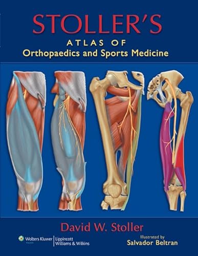 Stoller's Atlas of Orthopaedics and Sports Medicine von LWW