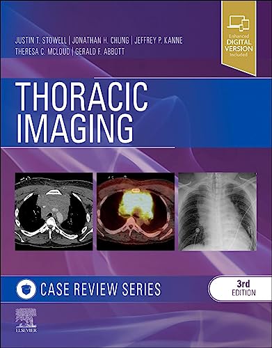 Thoracic Imaging: Case Review von Elsevier
