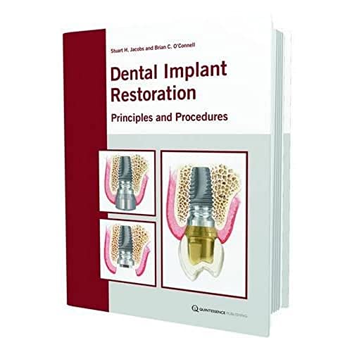 Dental Implant Restoration: Principles and Procedures
