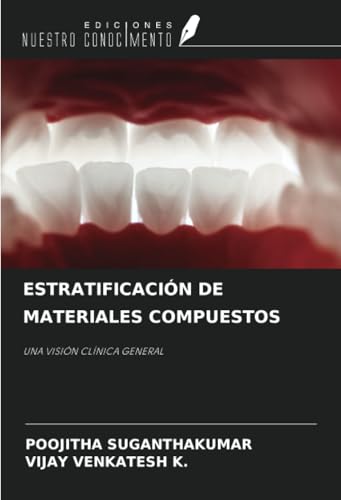 ESTRATIFICACIÓN DE MATERIALES COMPUESTOS: UNA VISIÓN CLÍNICA GENERAL von Ediciones Nuestro Conocimiento