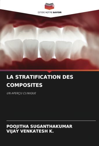 LA STRATIFICATION DES COMPOSITES: UN APERÇU CLINIQUE von Editions Notre Savoir