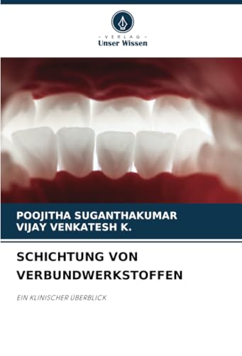 SCHICHTUNG VON VERBUNDWERKSTOFFEN: EIN KLINISCHER ÜBERBLICK von Verlag Unser Wissen