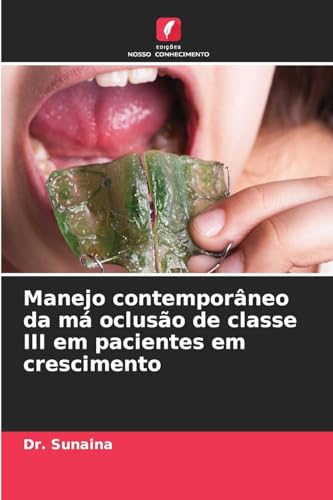 Manejo contemporâneo da má oclusão de classe III em pacientes em crescimento von Edições Nosso Conhecimento
