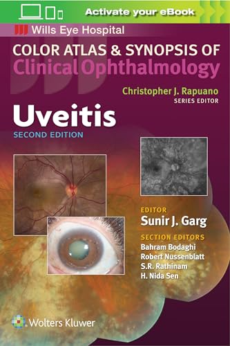 Uveitis (Color Atlas and Synopsis of Clinical Ophthalmology) (Color Atlas & Synopsis of Clinical Ophthalmology) von LWW