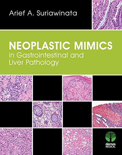 Neoplastic Mimics in Gastrointestinal and Liver Pathology (Pathology of Neoplastic Mimics)