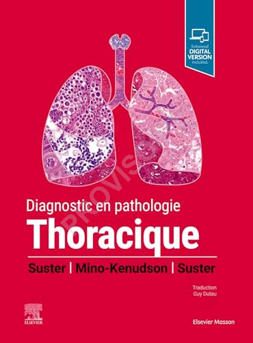 Diagnostic en pathologie thoracique Diagnostic en pathologie thoracique von Elsevier Masson