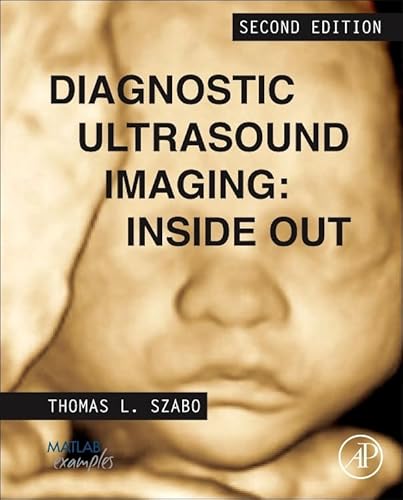 Diagnostic Ultrasound Imaging: Inside Out (Biomedical Engineering) von Academic Press