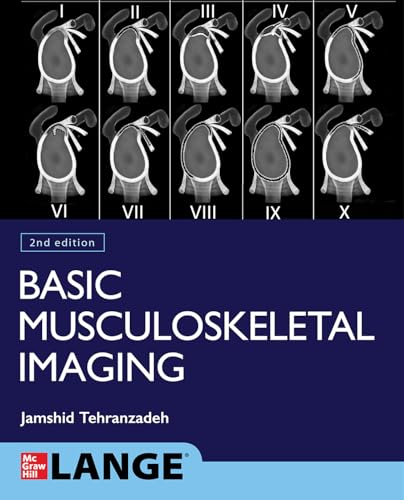 Basic Musculoskeletal Imaging, Second Edition Basic Musculoskeletal Imaging, Second Edition von McGraw Hill / Medical