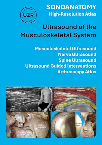 Sonoanatomy - High-Resolution Atlas - Ultrasound of the Musculoskeletal System: Musculoskeletal Ultrasound, Nerve Ultrasound, Spine Ultrasound, Ultrasound Guided Interventions, Arthroscopy Atlas von BoD – Books on Demand