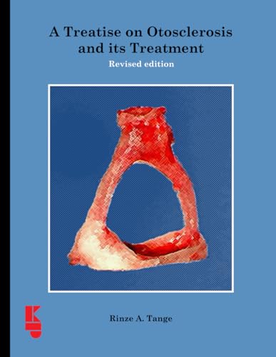 A Treatise on Otosclerosis and its Treatment: Revised edition von Kugler Publications