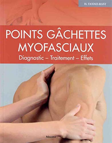 Points gâchettes Myofasciaux: Diagnostic ? traitement ? effets von MALOINE