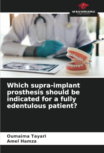 Which supra-implant prosthesis should be indicated for a fully edentulous patient? von Our Knowledge Publishing