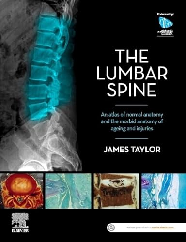 The Lumbar Spine: An Atlas of Normal Anatomy and the Morbid Anatomy of Ageing and Injury von Elsevier