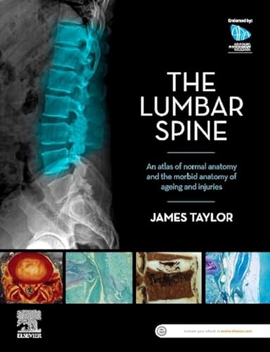 The Lumbar Spine: An Atlas of Normal Anatomy and the Morbid Anatomy of Ageing and Injury The Lumbar Spine: An Atlas of Normal Anatomy and the Morbid Anatomy of Ageing and Injury