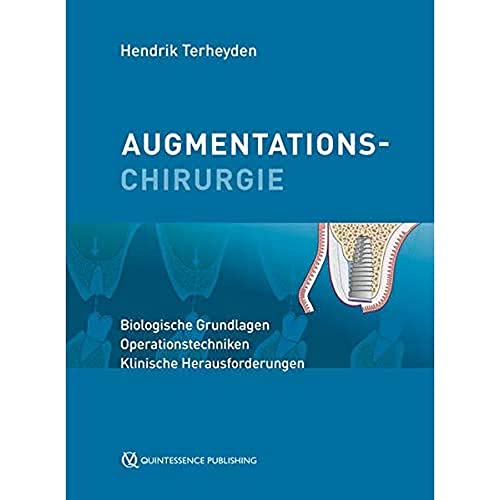 Augmentationschirurgie: Biologische Grundlagen, Operationstechniken, Klinische Herausforderungen von Quintessenz Verlag