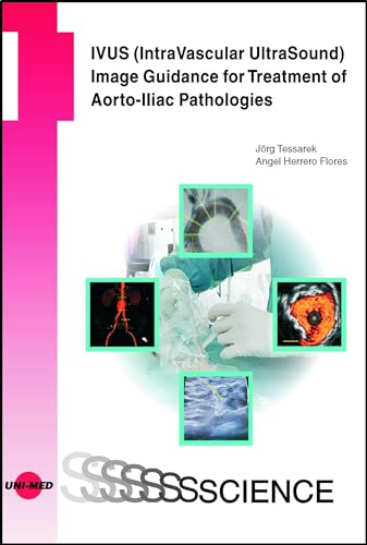 IVUS (IntraVascular UltraSound) Image Guidance for Treatment of Aorto-Iliac Pathologies (UNI-MED Science) von UNI-MED