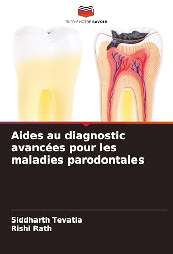 Aides au diagnostic avancées pour les maladies parodontales von Editions Notre Savoir