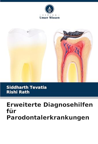 Erweiterte Diagnosehilfen für Parodontalerkrankungen: DE von Verlag Unser Wissen