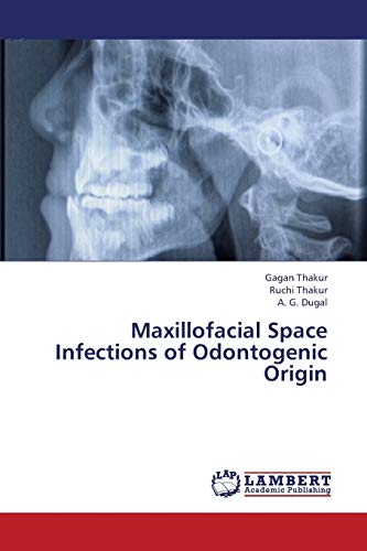 Maxillofacial Space Infections of Odontogenic Origin von LAP Lambert Academic Publishing