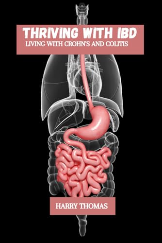 Thriving with IBD: Living with Crohn's and colitis von Independently published