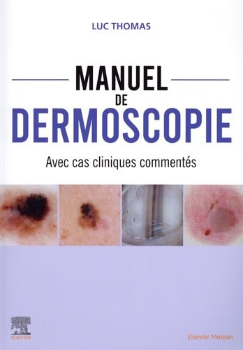 Manuel de dermoscopie: Avec cas cliniques commentés von MASSON