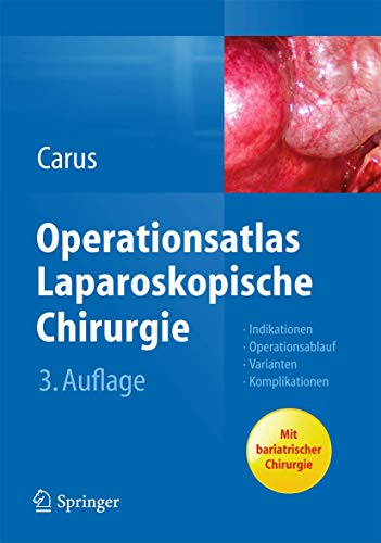 Operationsatlas Laparoskopische Chirurgie: Indikationen - Operationsablauf - Varianten - Komplikationen von Springer