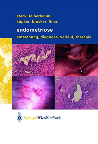 Endometriose: Entstehung, Diagnose, Verlauf und Therapie von Springer
