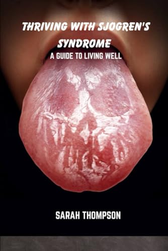 Thriving with sjogren's syndrome: A guide to living well Thriving with sjogren's syndrome: A guide to living well von Independently published