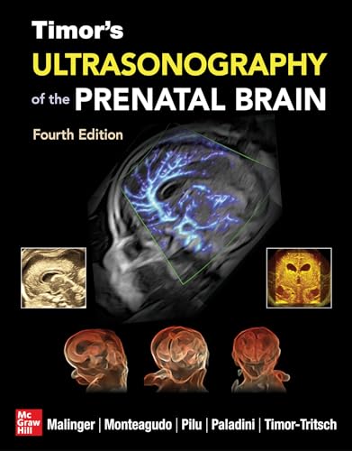 Timor's Ultrasonography of the Prenatal Brain (Medicina) von McGraw-Hill Education