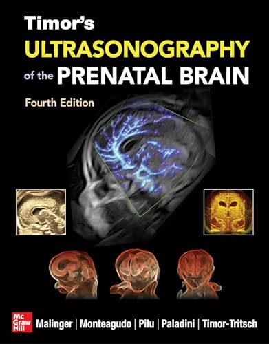 Timor's Ultrasonography of the Prenatal Brain (Medicina) Timor's Ultrasonography of the Prenatal Brain (Medicina) von McGraw-Hill Education