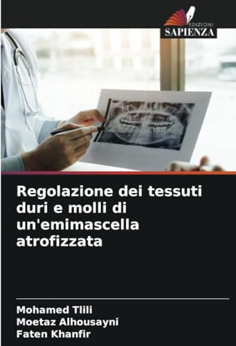 Regolazione dei tessuti duri e molli di un'emimascella atrofizzata von Edizioni Sapienza