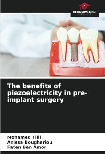 The benefits of piezoelectricity in pre-implant surgery: DE von Our Knowledge Publishing