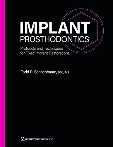 Implant Prosthodontics: Protocols and Techniques for Fixed Implant Restorations von Quintessence Publishing