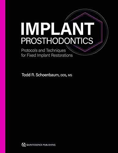 Implant Prosthodontics: Protocols and Techniques for Fixed Implant Restorations Implant Prosthodontics: Protocols and Techniques for Fixed Implant Restorations von Quintessence Publishing