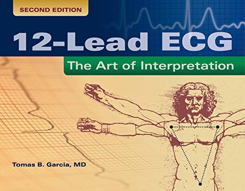 12-Lead ECG: The Art of Interpretation von Jones & Bartlett Publishers