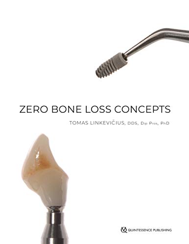 Zero Bone Loss Concepts von Quintessence Publishing (IL)