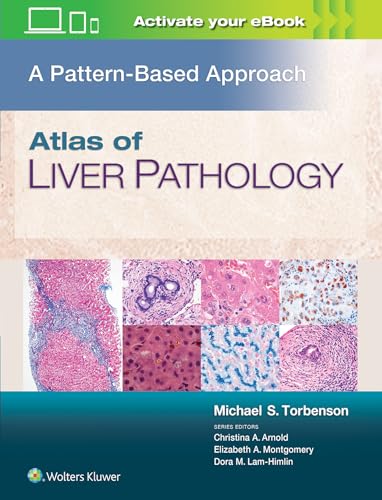 Atlas of Liver Pathology: A Pattern-Based Approach von WOLTERS KLUWER HEALTH