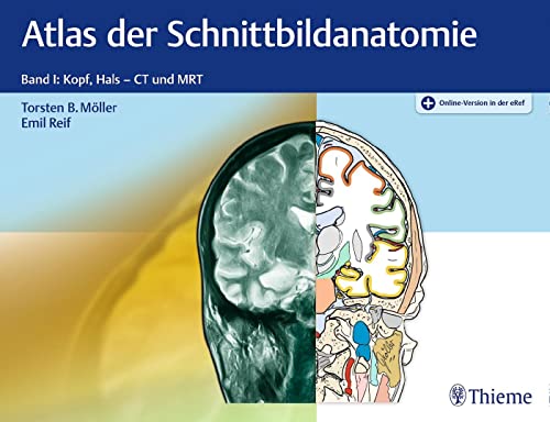 Atlas der Schnittbildanatomie: Band I: Kopf, Hals von Thieme