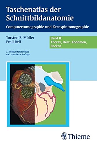 Taschenatlas der Schnittbildanatomie: Band II: Thorax, Herz, Abdomen, Becken von Thieme