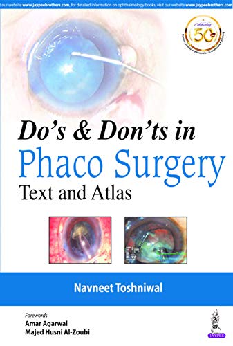 Do's & Dont's in Phaco Surgery: Text and Atlas