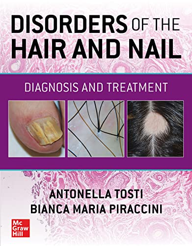 Disorders of the Hair and Nail: Diagnosis and Treatment von McGraw-Hill Education
