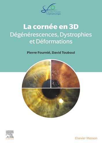 La Cornée en 3D : dégénérescences, dystrophies et déformations cornéennes von MASSON